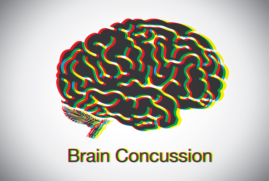 bigstock-Brain-concussion-120745988 (1)